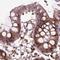 Glucosidase II Alpha Subunit antibody, NBP2-49332, Novus Biologicals, Immunohistochemistry paraffin image 