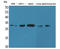 TNF Superfamily Member 13b antibody, STJ96531, St John