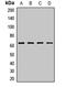 Inositol 1,4,5-Trisphosphate Receptor Interacting Protein antibody, orb411881, Biorbyt, Western Blot image 