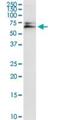 Adenylate Kinase 5 antibody, H00026289-D01P, Novus Biologicals, Western Blot image 