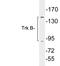 Neurotrophic Receptor Tyrosine Kinase 2 antibody, LS-C200033, Lifespan Biosciences, Western Blot image 