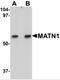 Matrilin 1 antibody, 5125, ProSci, Western Blot image 