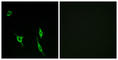 DCC Netrin 1 Receptor antibody, abx014019, Abbexa, Western Blot image 