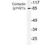 Cortactin antibody, LS-C178045, Lifespan Biosciences, Western Blot image 