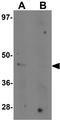 NK2 Homeobox 4 antibody, GTX32058, GeneTex, Western Blot image 