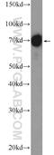Moesin antibody, 26053-1-AP, Proteintech Group, Western Blot image 