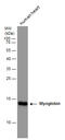 Myoglobin antibody, GTX108434, GeneTex, Western Blot image 