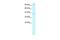 Kinesin Family Member C2 antibody, GTX47724, GeneTex, Western Blot image 