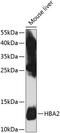 Hemoglobin Subunit Alpha 2 antibody, GTX65974, GeneTex, Western Blot image 