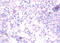 RELT TNF Receptor antibody, LS-C316599, Lifespan Biosciences, Immunohistochemistry paraffin image 