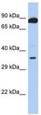 Testis Expressed 9 antibody, TA333356, Origene, Western Blot image 