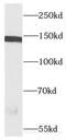 Centrosome And Spindle Pole Associated Protein 1 antibody, FNab02026, FineTest, Western Blot image 