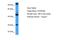Pleckstrin Homology And RhoGEF Domain Containing G6 antibody, A11547, Boster Biological Technology, Western Blot image 