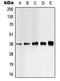 Casein Kinase 1 Alpha 1 antibody, GTX32170, GeneTex, Western Blot image 