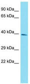 Kynurenine Aminotransferase 3 antibody, TA335505, Origene, Western Blot image 
