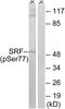 Serum Response Factor antibody, PA5-40182, Invitrogen Antibodies, Western Blot image 
