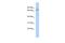 Taperin antibody, A13139, Boster Biological Technology, Western Blot image 