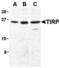 Toll Like Receptor Adaptor Molecule 2 antibody, MBS150354, MyBioSource, Western Blot image 