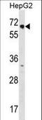 Nuclear Receptor Subfamily 2 Group C Member 1 antibody, LS-C162989, Lifespan Biosciences, Western Blot image 