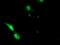 EPM2A Interacting Protein 1 antibody, MA5-25256, Invitrogen Antibodies, Immunocytochemistry image 