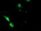 EPM2A Interacting Protein 1 antibody, MA5-25256, Invitrogen Antibodies, Immunocytochemistry image 