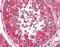 EPH Receptor A2 antibody, 48-099, ProSci, Immunohistochemistry frozen image 