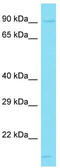 GRAM Domain Containing 1B antibody, TA331820, Origene, Western Blot image 