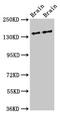 Microtubule Associated Serine/Threonine Kinase 3 antibody, CSB-PA013513LA01HU, Cusabio, Western Blot image 