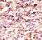 Activin A Receptor Type 1C antibody, LS-C98081, Lifespan Biosciences, Immunohistochemistry paraffin image 
