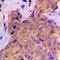 Cortactin antibody, GTX32325, GeneTex, Immunohistochemistry paraffin image 