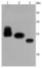CD59 Molecule (CD59 Blood Group) antibody, NBP2-66758, Novus Biologicals, Western Blot image 