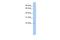 Tumor Suppressor Candidate 1 antibody, A15296, Boster Biological Technology, Western Blot image 