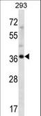 Ankyrin Repeat Domain 60 antibody, LS-C161069, Lifespan Biosciences, Western Blot image 