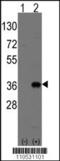 Msh Homeobox 2 antibody, 61-435, ProSci, Western Blot image 