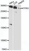 Inositol 1,4,5-Trisphosphate Receptor Type 3 antibody, A12794, ABclonal Technology, Western Blot image 