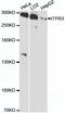 Inositol 1,4,5-trisphosphate receptor type 3 antibody, A12794, ABclonal Technology, Western Blot image 