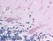 Chromodomain Helicase DNA Binding Protein 4 antibody, LS-B204, Lifespan Biosciences, Immunohistochemistry paraffin image 