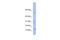 Putative TLX1 neighbor protein antibody, A18962, Boster Biological Technology, Western Blot image 