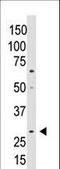 Cellular Communication Network Factor 5 antibody, LS-C100503, Lifespan Biosciences, Western Blot image 