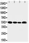 Solute Carrier Family 16 Member 4 antibody, PA2189, Boster Biological Technology, Western Blot image 