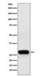 Casein Beta antibody, M03701, Boster Biological Technology, Western Blot image 