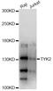 Tyrosine Kinase 2 antibody, MBS126617, MyBioSource, Western Blot image 