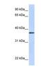 Transmembrane Protein 200B antibody, NBP1-91575, Novus Biologicals, Western Blot image 