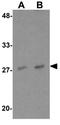 Nedd4 Family Interacting Protein 1 antibody, GTX17176, GeneTex, Western Blot image 