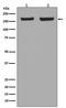 Early Endosome Antigen 1 antibody, M02296, Boster Biological Technology, Western Blot image 