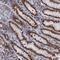 THAP Domain Containing 2 antibody, PA5-58929, Invitrogen Antibodies, Immunohistochemistry paraffin image 