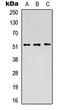 Protein Interacting With PRKCA 1 antibody, LS-C354467, Lifespan Biosciences, Western Blot image 