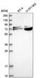 Replication Protein A1 antibody, NBP2-55485, Novus Biologicals, Western Blot image 