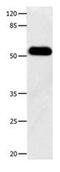 Docking Protein 3 antibody, PA5-49701, Invitrogen Antibodies, Western Blot image 