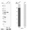 HNF1 Homeobox B antibody, MA5-24605, Invitrogen Antibodies, Western Blot image 